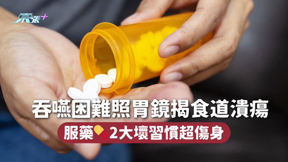 吞嚥困難照胃鏡揭食道潰瘍 服藥💊2大壞習慣超傷身