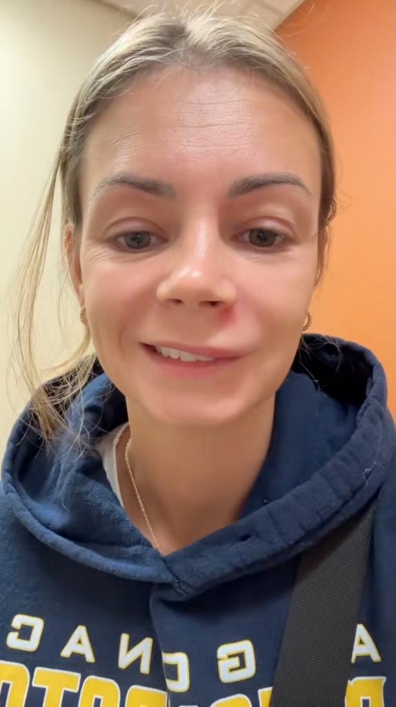 莉許瑪莉 (Lish Marie) 警告人們不要擠位於「死亡三角區」的一顆痘痘，因為她自己也因此被緊急送往醫院。