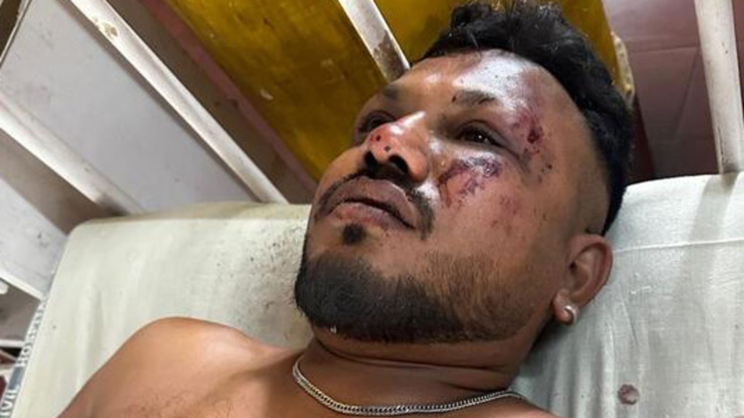 維什瓦什·庫馬爾·拉梅什 (Vishwash Kumar Ramesh) 是印度航空 171 航班墜機事故中唯一的倖存者。