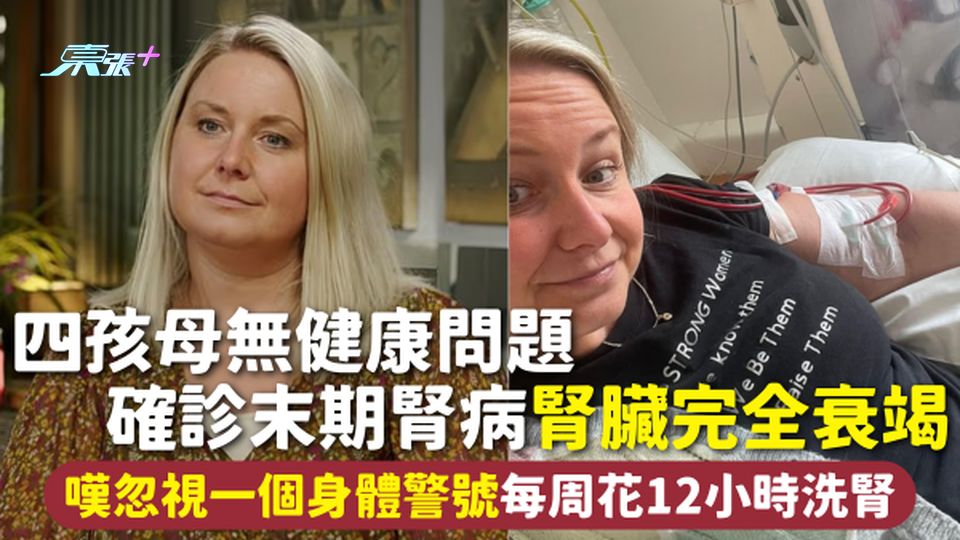 腎衰竭 | 四孩母無健康問題 確診末期腎病腎臟完全衰竭 嘆忽視一個身體警號 每周花12小時洗腎