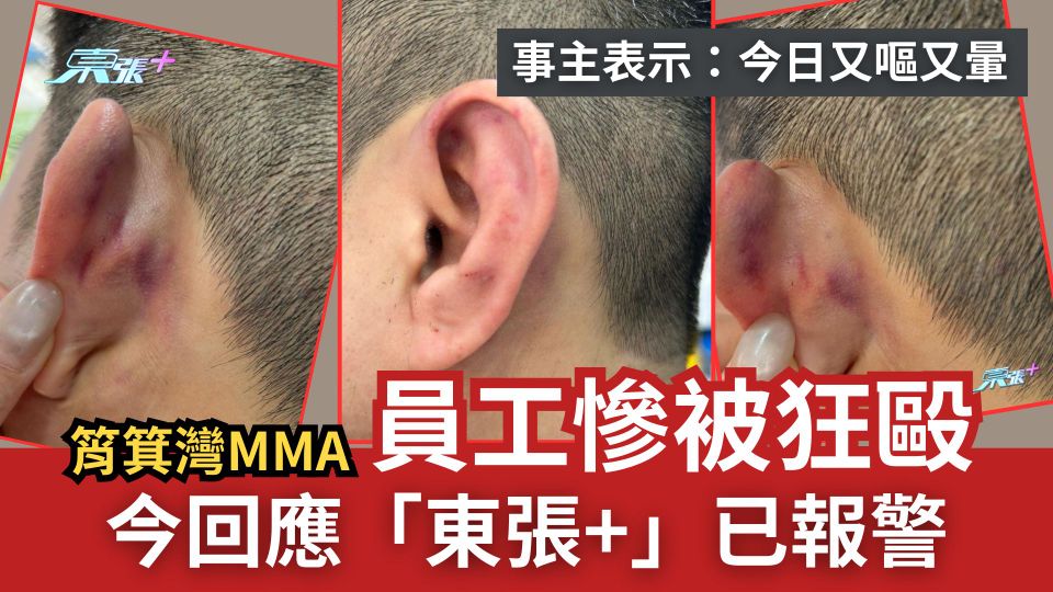 筲箕灣MMA｜員工慘被狂毆　今回應「東張+」已報警　事主：今日又嘔又暈