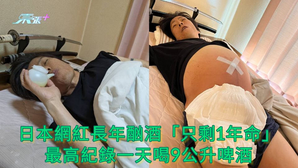 日本網紅長年酗酒「只剩1年命」 最高紀錄一天喝9公升啤酒