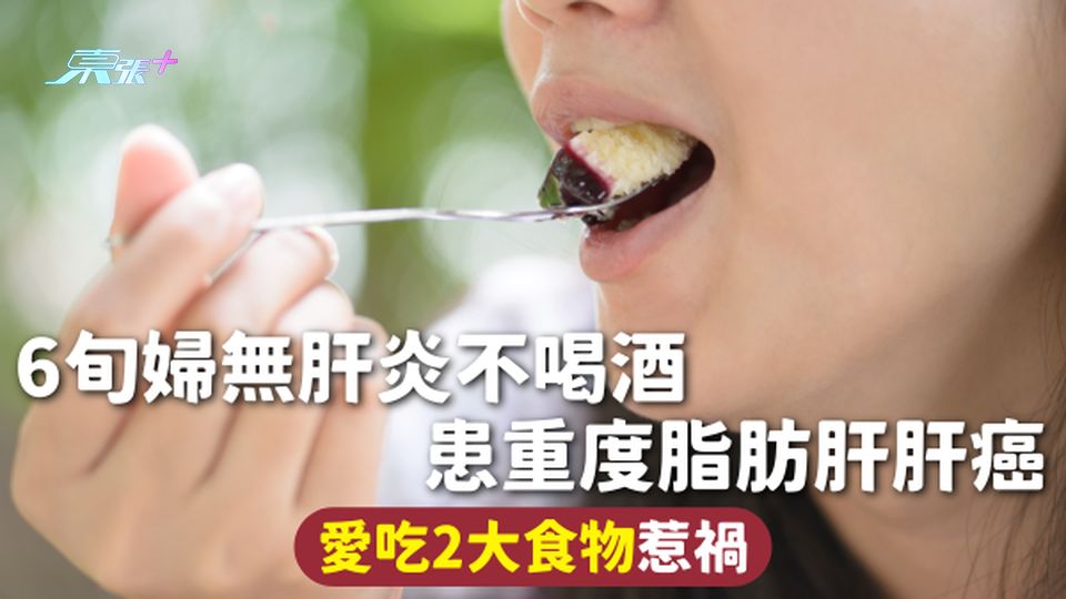 肝臟健康 | 6旬婦無肝炎不喝酒 患重度脂肪肝肝癌 愛吃2大食物惹禍