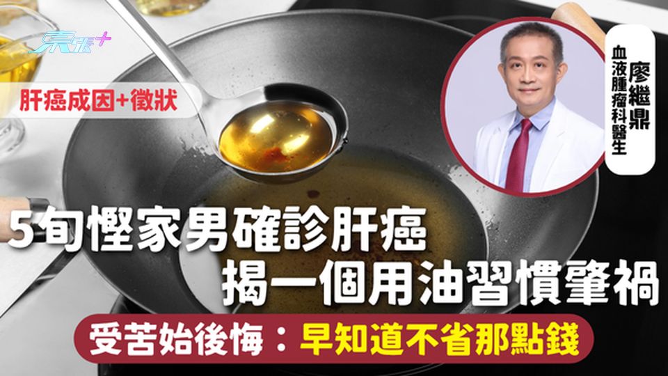 肝癌 | 5旬慳家男確診肝癌 揭一個用油習慣肇禍 受苦始後悔：早知道不省那點錢 附肝癌成因+徵狀