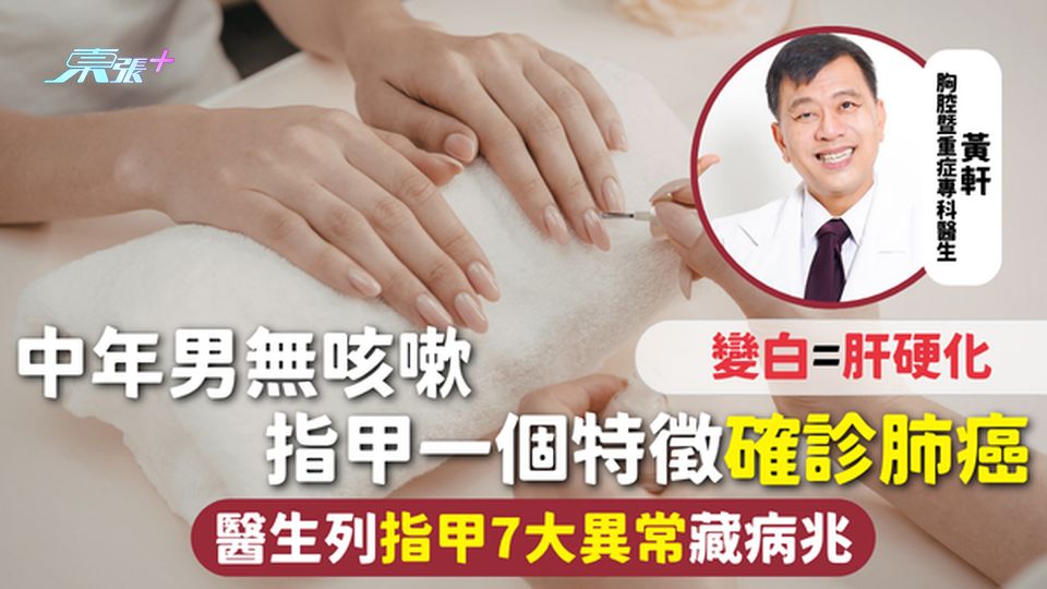 指甲健康 | 中年男無咳嗽 指甲一個特徵確診肺癌 醫生列指甲7大異常藏病兆 變白=肝硬化 