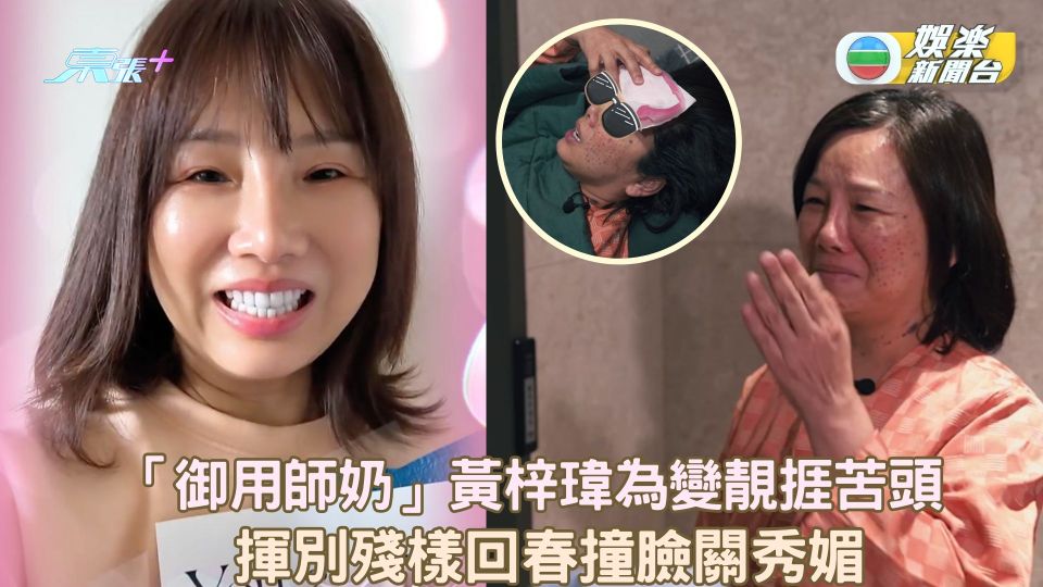 「御用師奶」黃梓瑋為變靚捱苦頭 揮別殘樣回春撞臉關秀媚？ - 東張+