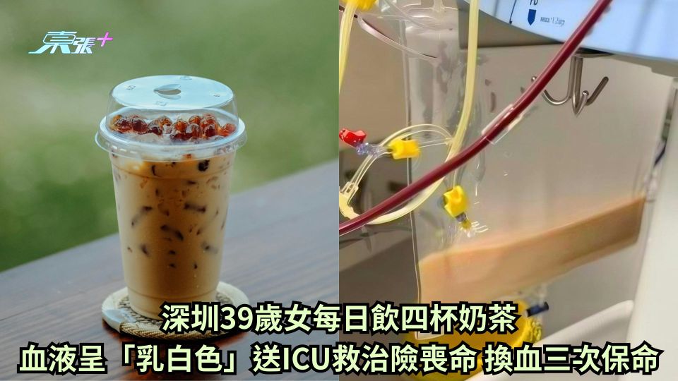 深圳39歲女日飲四杯奶茶血液呈「乳白色」 送ICU搶救換血3次保命