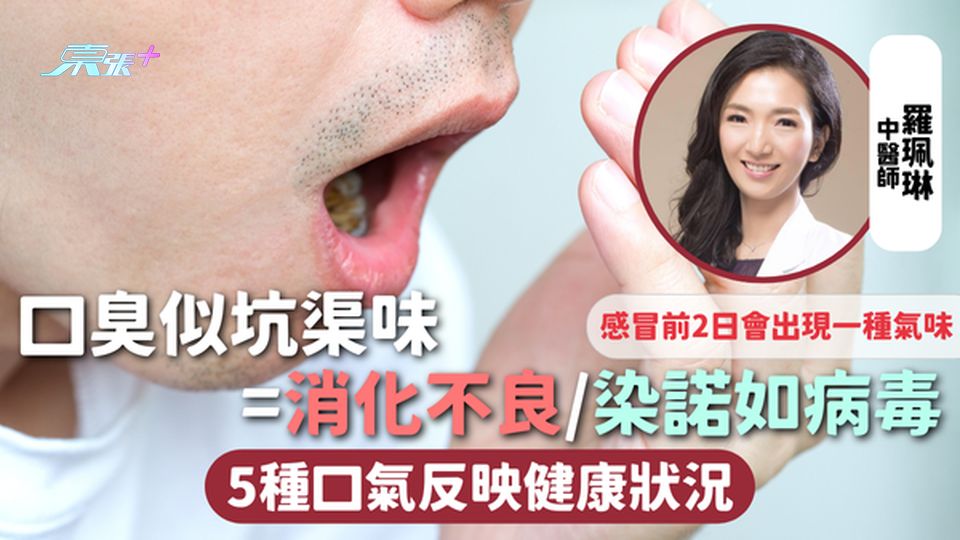 口氣問題 | 口臭似坑渠味=消化不良/染諾如病毒 5種口氣反映健康狀況 感冒前2日會出現一種氣味