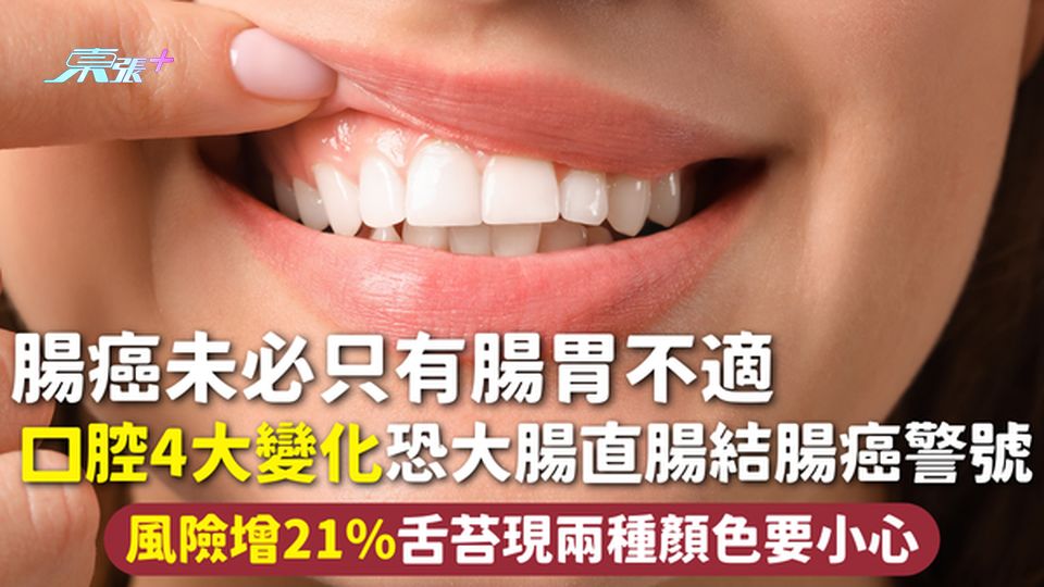 腸癌未必只有腸胃不適 口腔4大變化恐大腸直腸結腸癌警號 風險增21%舌苔現兩種顏色要小心