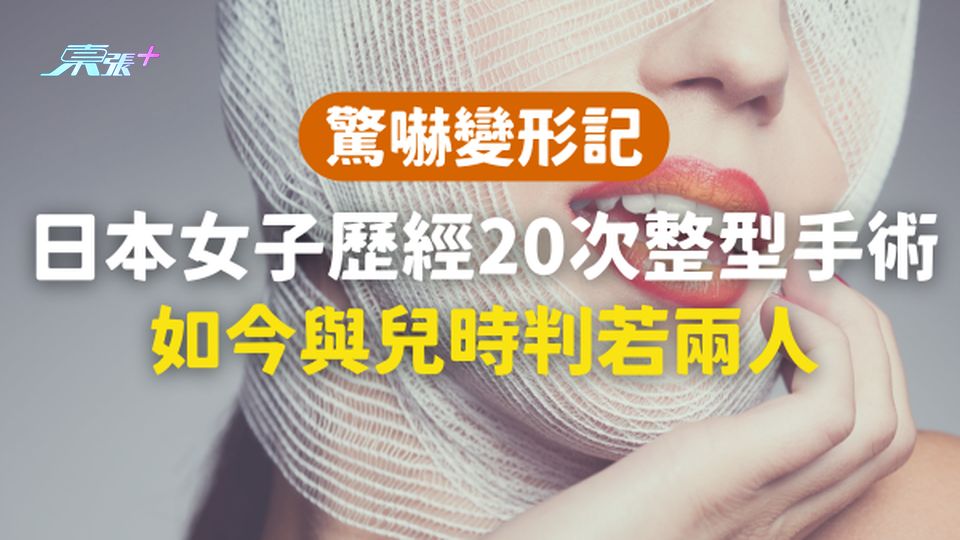 【變形記】日本女子歷經20次整型手術,如今與兒時判若兩人!