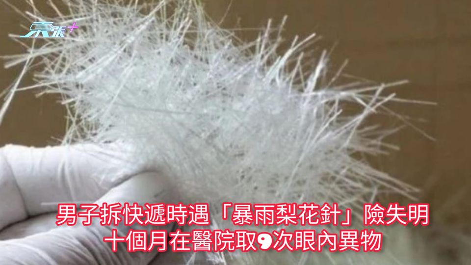 男子拆快遞時遇「暴雨梨花針」險失明 十個月在醫院9次取眼內異物