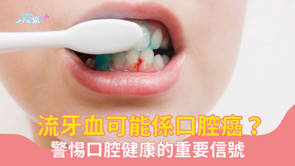 流牙血可能係口腔癌？警惕口腔健康的重要信號 #至識健康