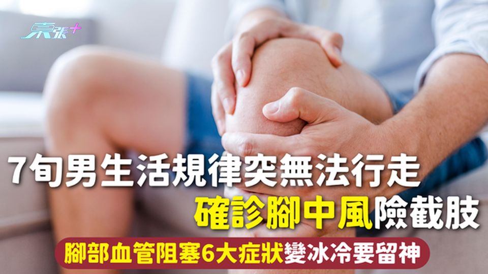 腳中風 | 7旬男生活規律突無法行走 確診腳中風險截肢 腳部血管阻塞6大症狀變冰冷要留神