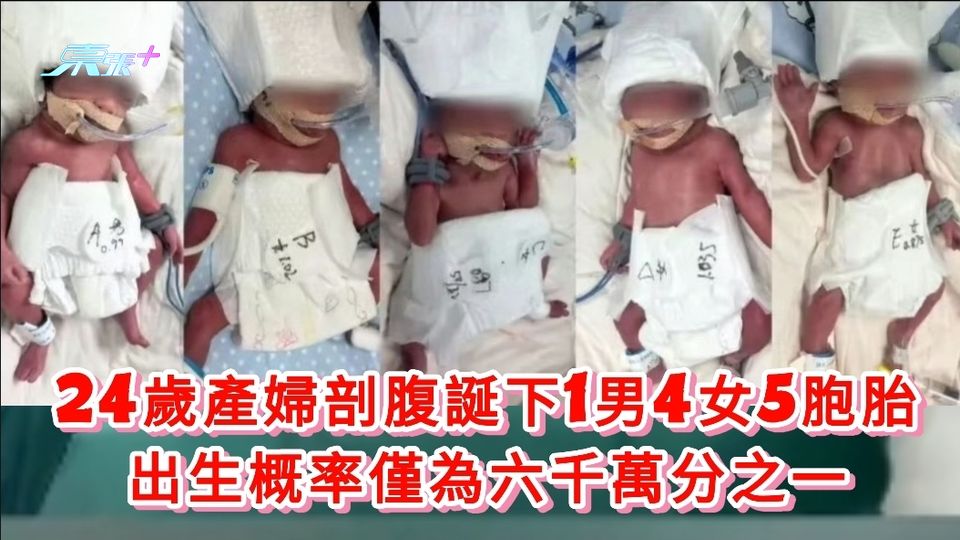 24歲產婦剖腹誕下1男4女5胞胎 出生概率僅為六千萬分之一