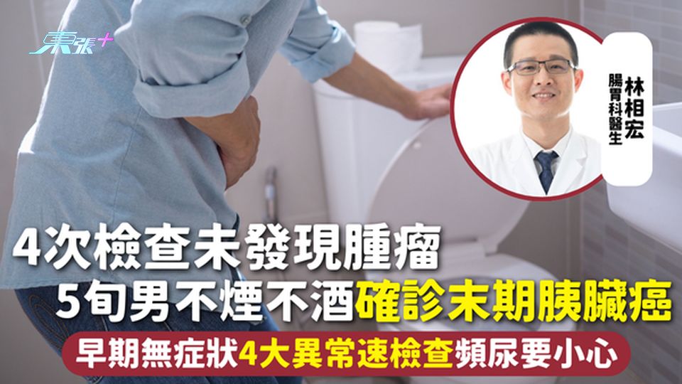 胰臟癌 | 4次檢查未發現腫瘤 5旬男不煙不酒確診末期胰臟癌 早期無症狀4大異常速檢查頻尿要小心