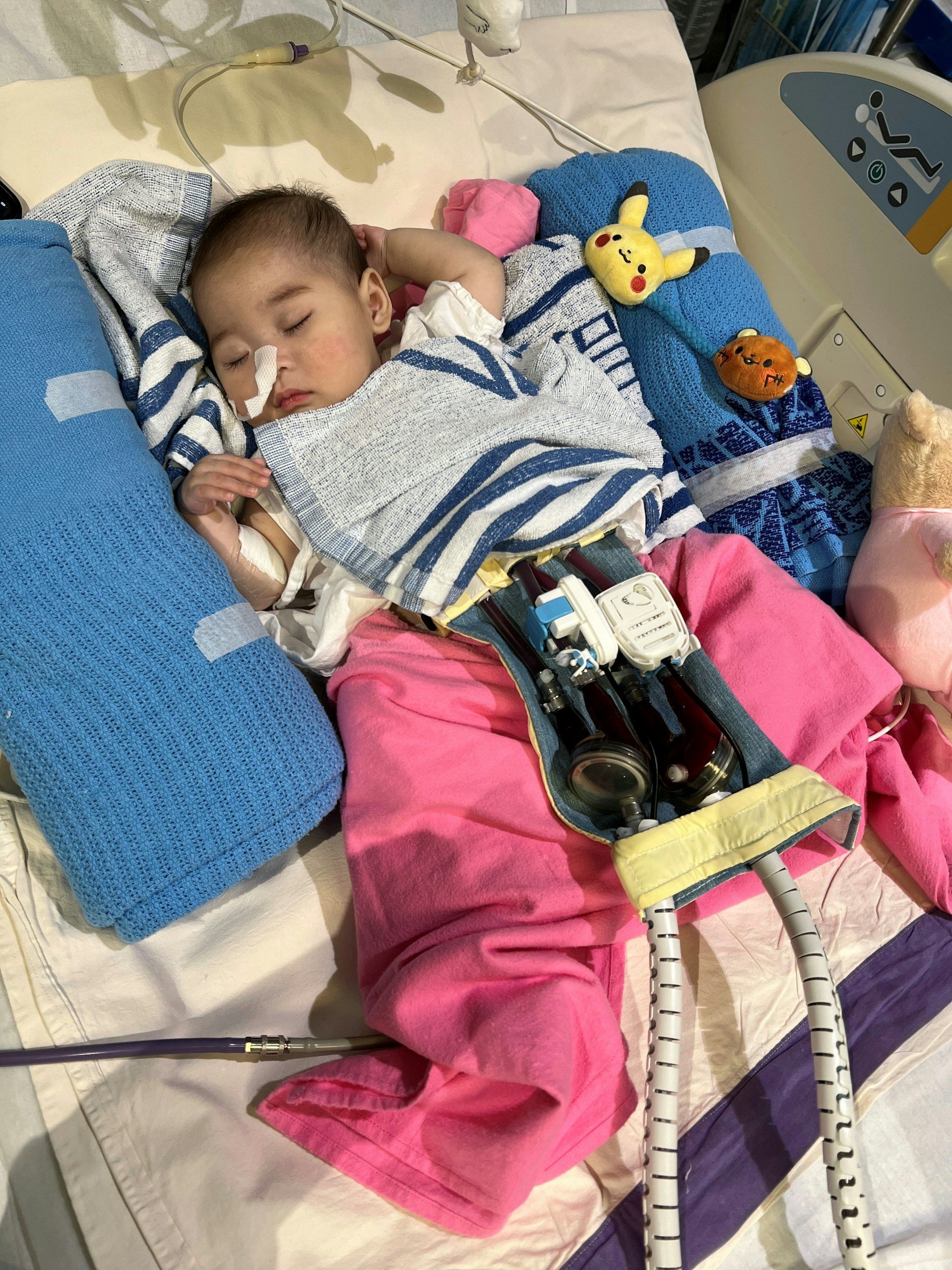 7個月大女嬰祈祈情況危殆急需換心。(醫管局提供)