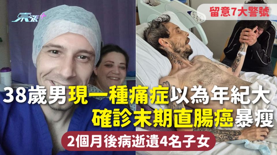 直腸癌 | 38歲男現一種痛症以為年紀大 確診末期直腸癌暴瘦 2個月後病逝遺4名子女 留意7大警號