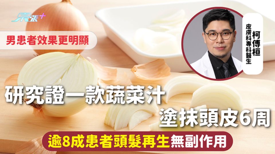 治療禿頭 | 研究證一款蔬菜汁塗抹頭皮6周 逾8成患者頭髮再生無副作用 男患者效果更明顯