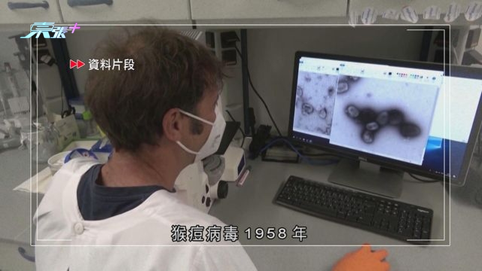 據報世衞擬將猴痘易名為MPOX免污名化 最快周三公布