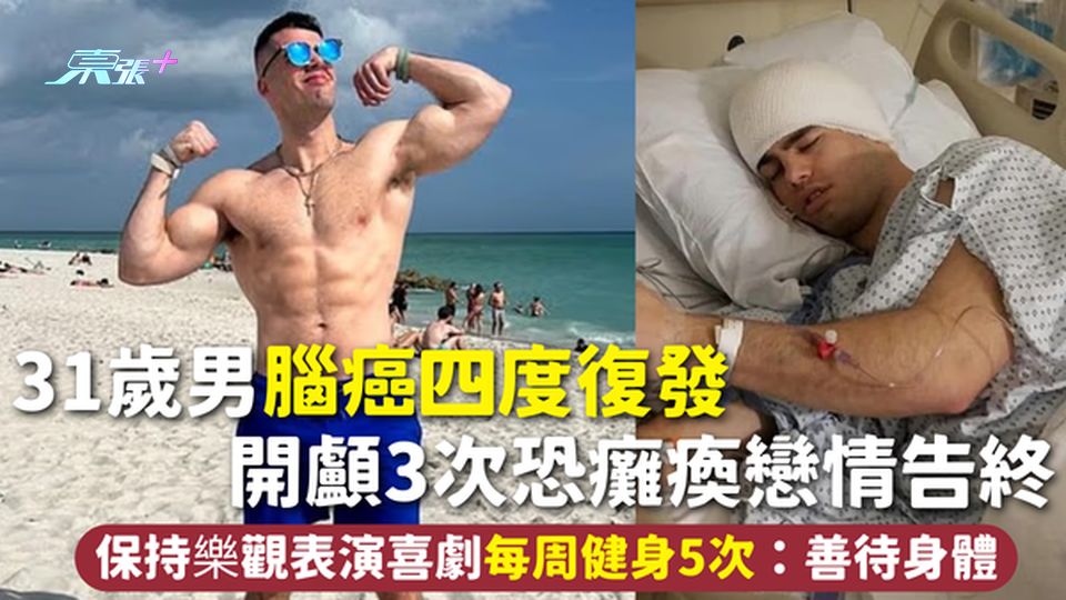 腦癌 | 31歲男腦癌四度復發 開顱3次恐癱瘓戀情告終 保持樂觀表演喜劇每周健身5次：善待身體