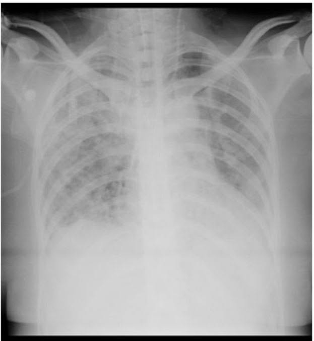 May be an image of bone and xray