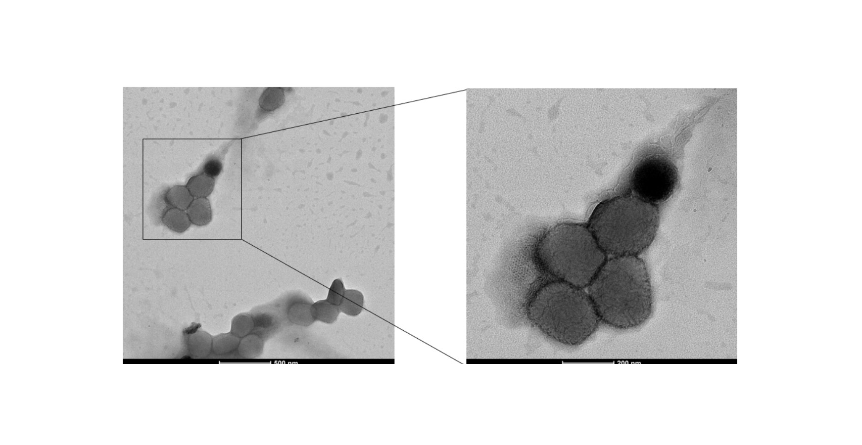 猴痘病毒電鏡圖，網絡圖片