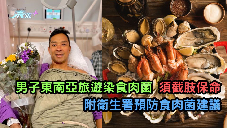 男子東南亞旅遊染食肉菌 須截肢保命  附衛生署預防食肉菌建議