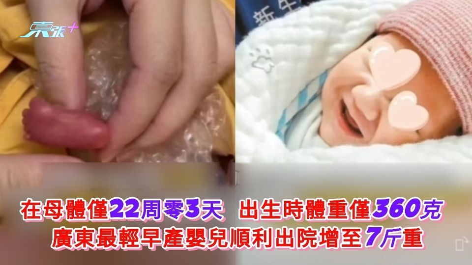 有片|出生時體重僅360克  廣東最輕超早產兒順利出院增磅至7斤重