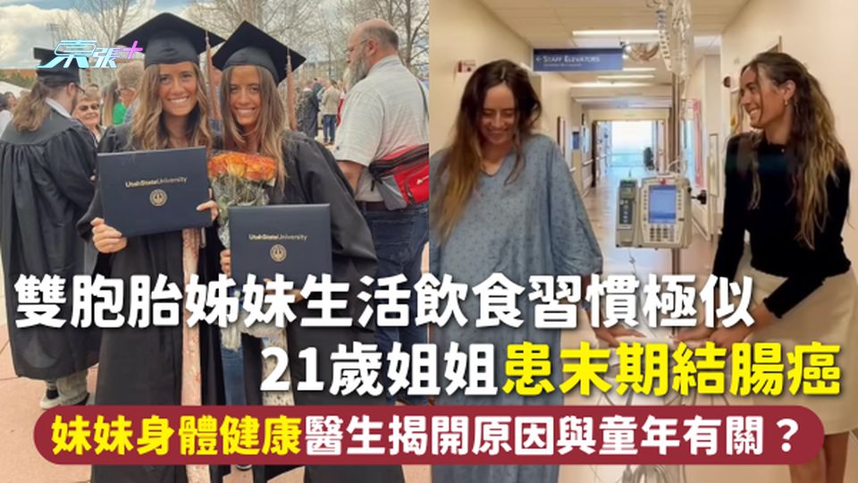 結腸癌 | 雙胞胎姊妹生活飲食習慣極似 21歲姐姐患末期結腸癌 妹妹身體健康醫生揭開原因與童年有關？