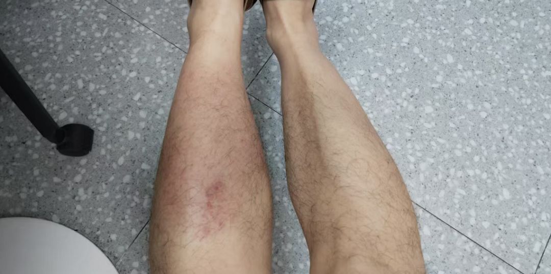 图源：深圳市第三人民医院