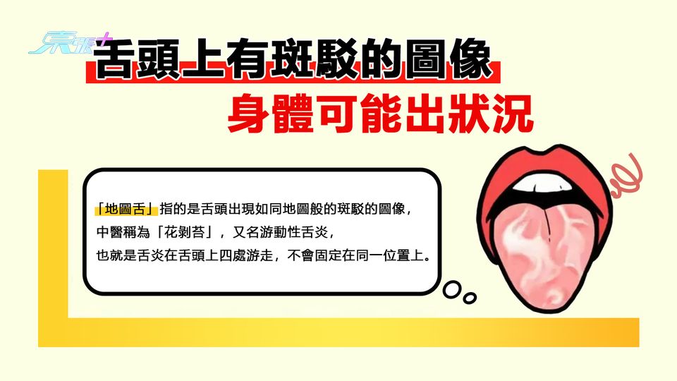 舌頭上有斑駁的圖像身體可能出狀況