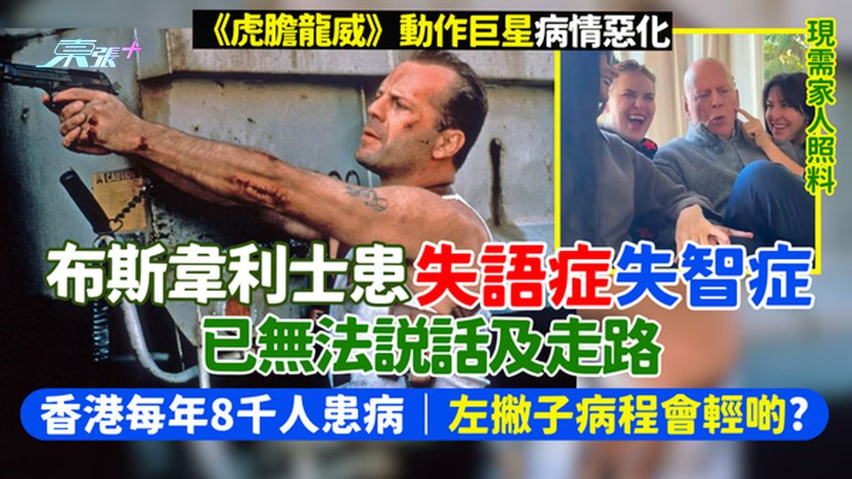 失語症｜《虎膽龍威》動作巨星布斯韋利士病情惡化 無法說話走路/香港每年8千人患病/左撇子病程會輕啲？