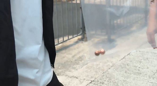 西環女途人疑遭氣槍射傷額頭流血送院，現場遺下金屬珠，警方正調查事件。