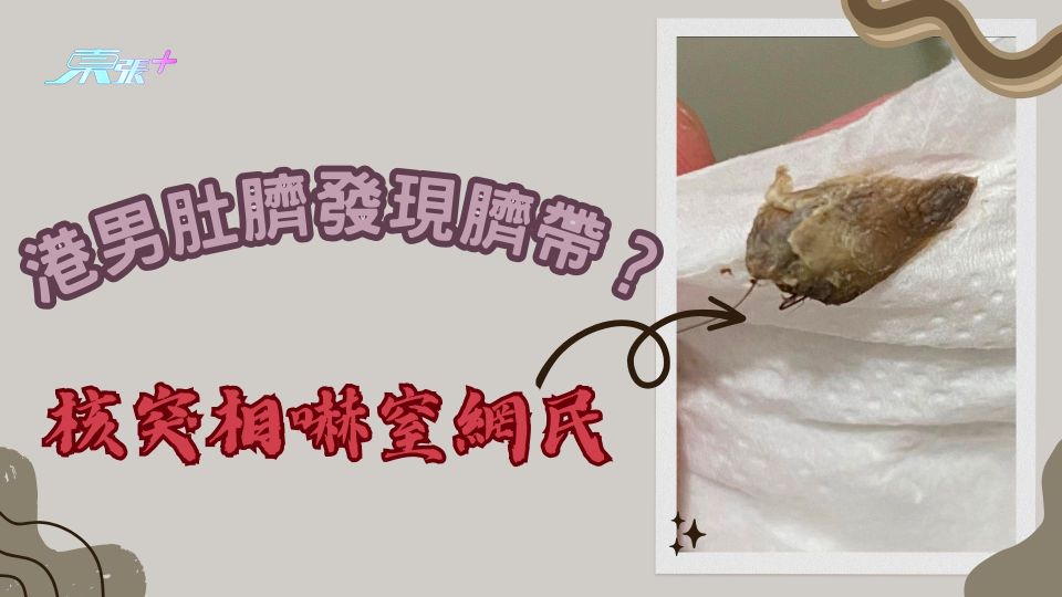 港男肚臍發現臍帶？核突相嚇窒網民：唔使咁客氣 收返埋！