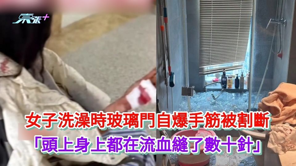 有片|女子洗澡時玻璃門自爆手筋被割斷 頭上身上都在流血縫了數十針