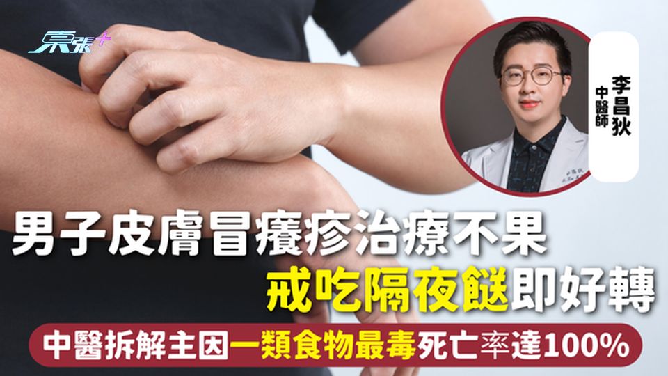 隔夜餸 | 男子皮膚冒癢疹治療不果 戒吃隔夜餸即好轉 中醫拆解主因一類食物最毒死亡率達100%