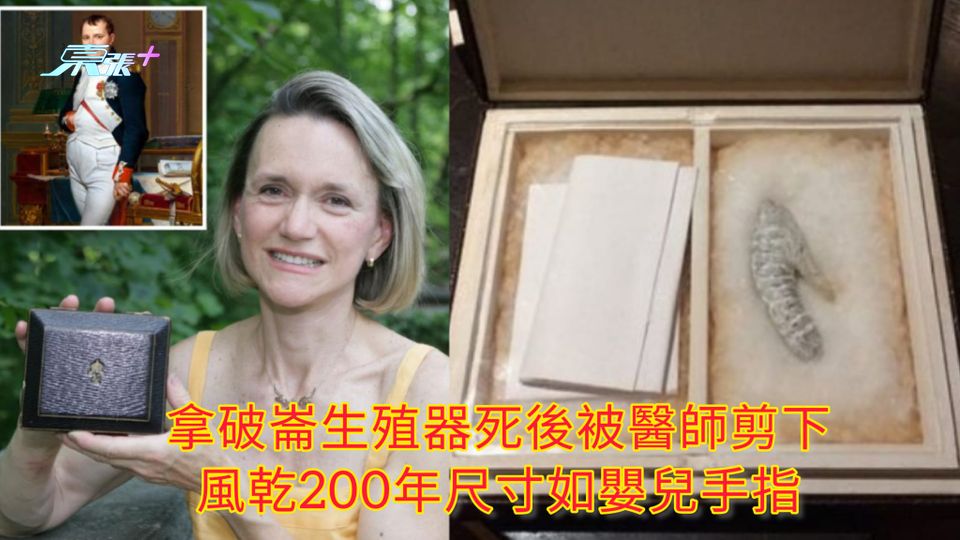 拿破崙生殖器死後被醫師剪下 風乾200年尺寸如嬰兒手指