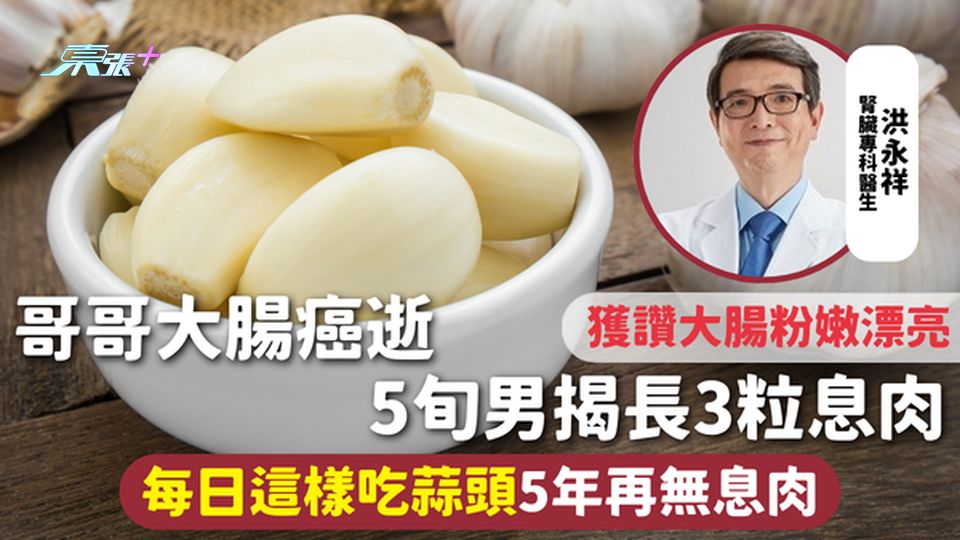 大腸健康 | 哥哥大腸癌逝 5旬男揭長3粒息肉 每日這樣吃蒜頭 5年再無息肉獲讚大腸粉嫩漂亮