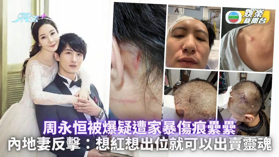 周永恒被爆疑遭家暴傷痕纍纍 內地妻反擊：想紅想出位就可以出賣靈魂？