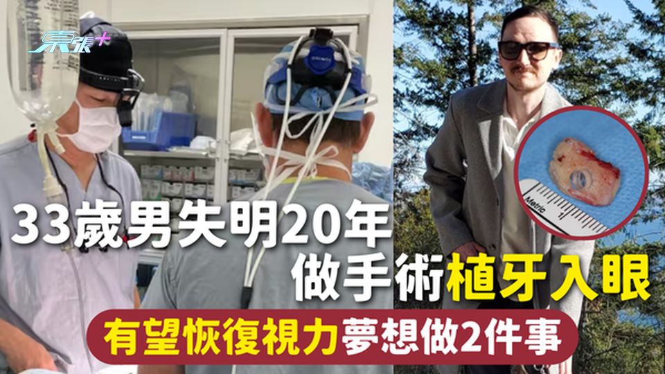 重見光明 | 33歲男失明20年 做手術植牙入眼 有望恢復視力 夢想做2件事
