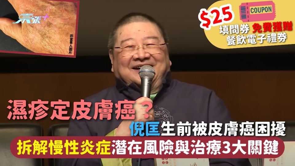 濕疹定皮膚癌？倪匡生前被皮膚癌困擾 拆解慢性炎症潛在風險與治療3大關鍵