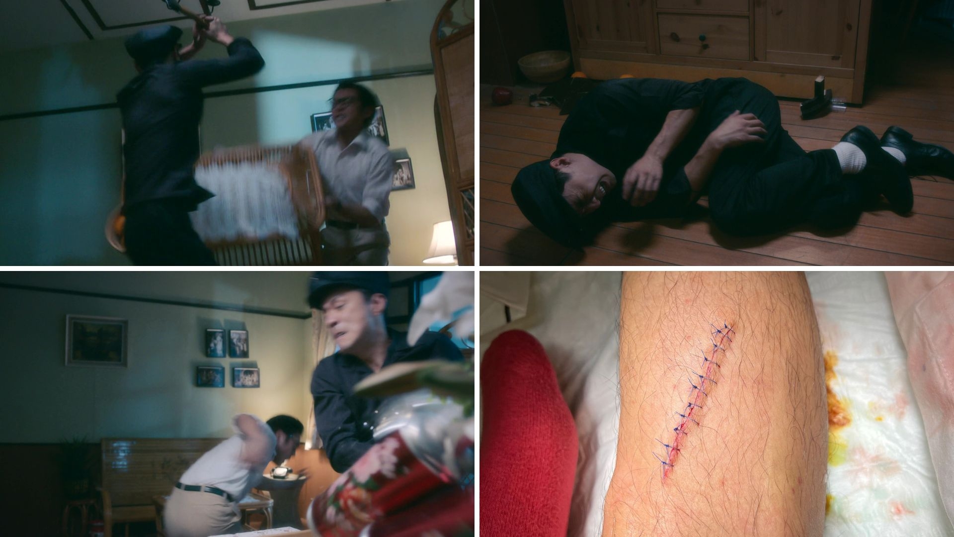 俊堅拍攝《靈戲一度因意外遭鋼鐵刮到腳、縫足足 11 針，但當時仍有大量打鬥場面未拍攝，最終決定頂硬上拍落去。