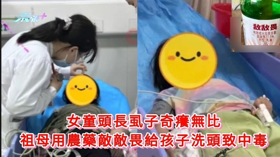 2女童頭長虱子奇癢無比 祖母用農藥敵敵畏給孩子洗頭致中毒