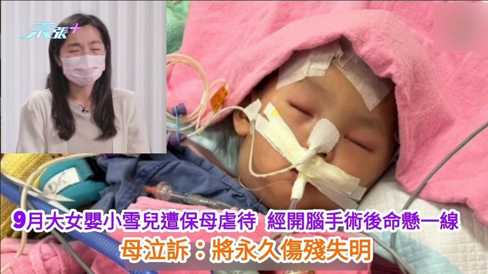 屯門9月大女嬰遭保母虐待 經開腦手術命懸一線　母泣訴：將永久傷殘失明