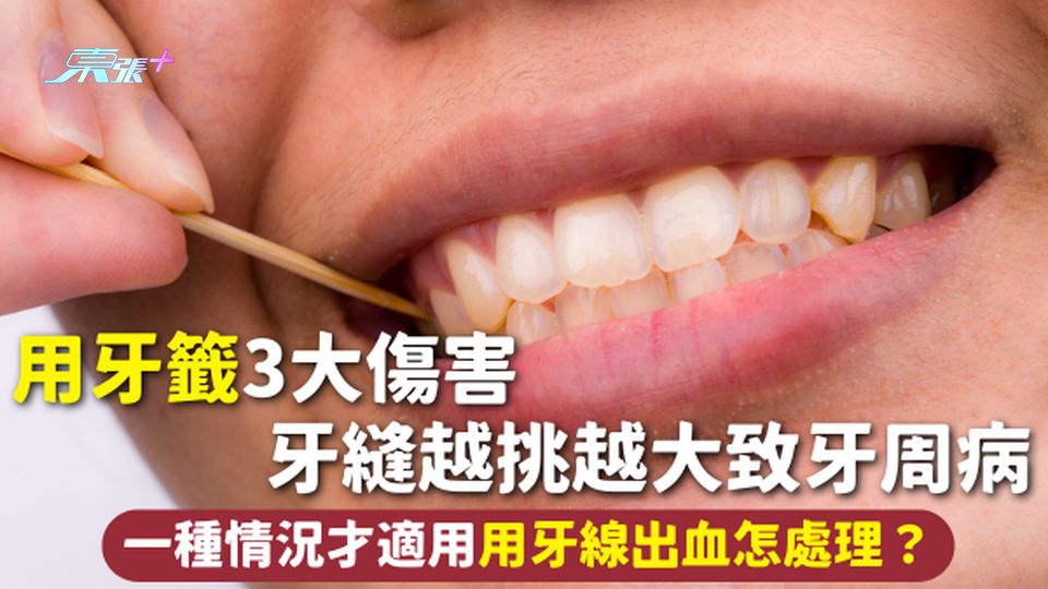 牙齒健康 | 用牙籤3大傷害 牙縫越挑越大致牙周病 一種情況才適用 用牙線出血怎處理？