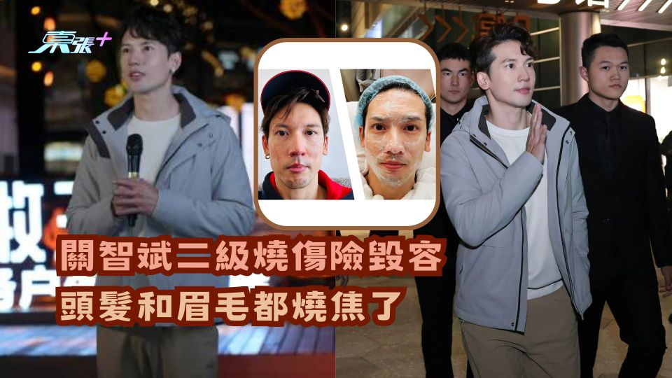 關智斌二級燒傷險毀容 頭髮和眉毛都燒焦了 