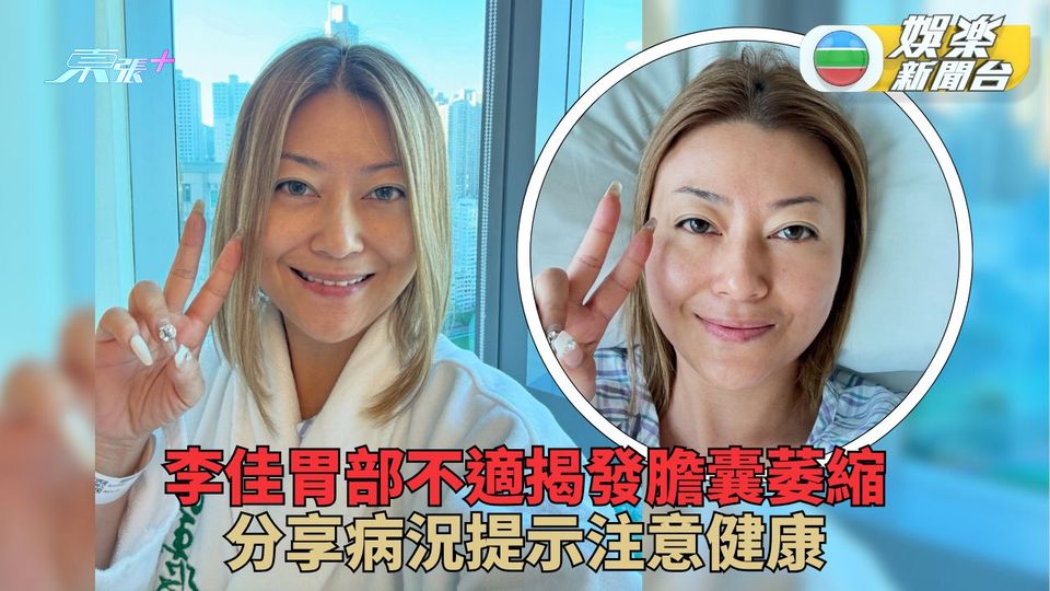 李佳胃部不適揭發膽囊萎縮 分享病況提示大家注意健康