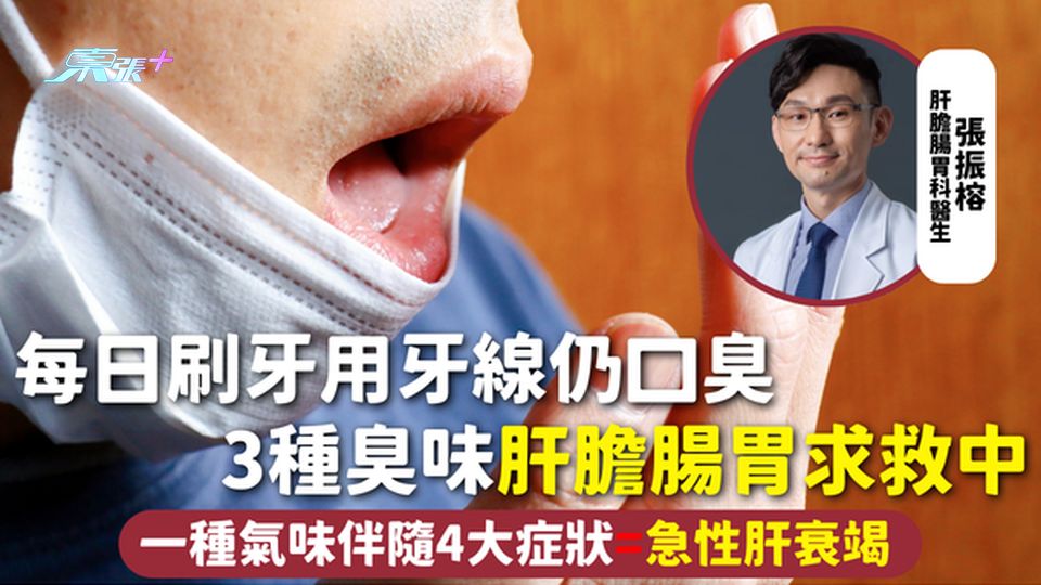 口臭 | 每日刷牙用牙線仍口臭 3種臭味肝膽腸胃求救中 一種氣味伴隨4大症狀=急性肝衰竭