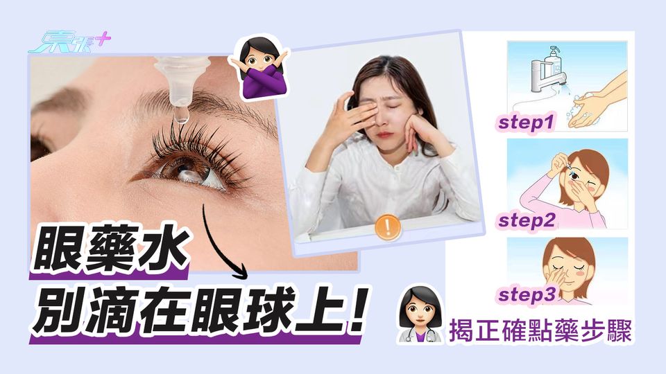 眼藥水別滴在眼球上！揭正確點藥步驟