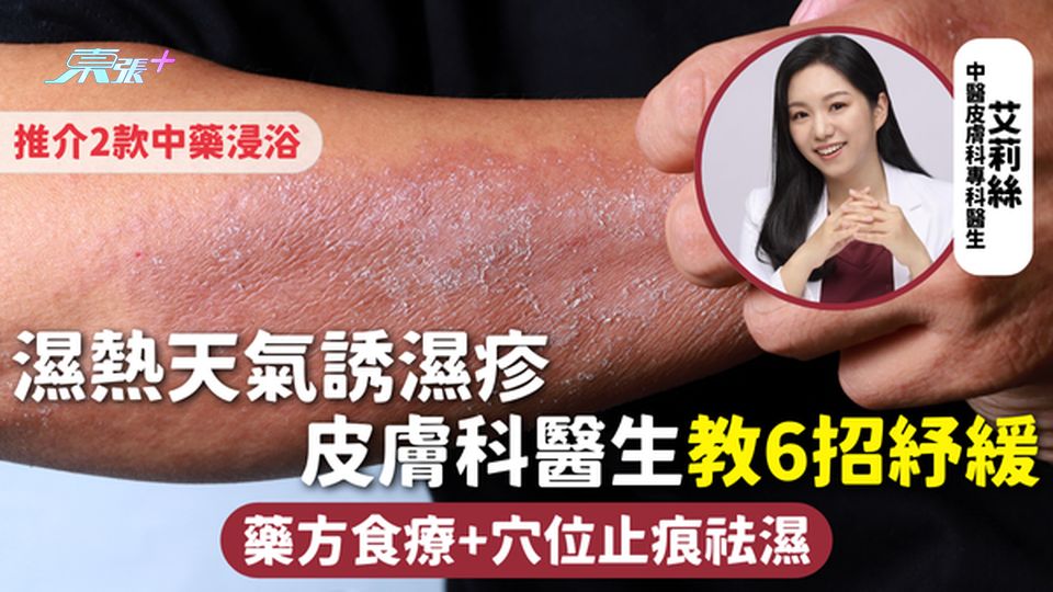 夏季濕疹 | 濕熱天氣誘濕疹 皮膚科醫生教6招紓緩 藥方食療+穴位止痕祛濕 推介2款中藥浸浴